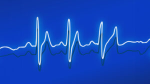 Herzschlag - Frequenz auf blauem Hintergrund